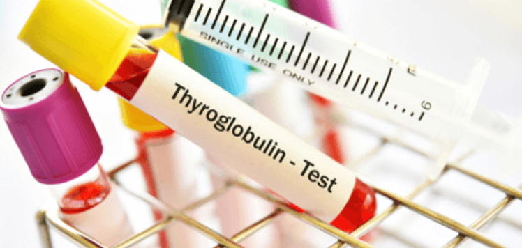 Thyroglobulin: Phạm vi bình thường, nồng độ cao & ung thư tuyến giáp