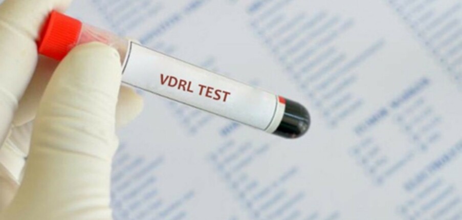 Xét nghiệm sàng lọc bệnh giang mai VDRL: Mục đích, quy trình và kết quả