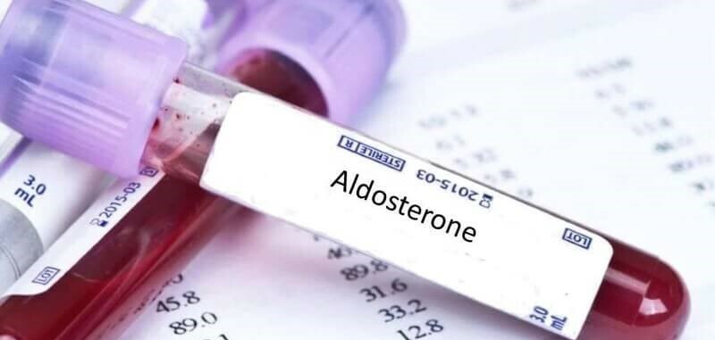 Xét nghiệm aldosterone: Mục đích, quy trình và kết quả