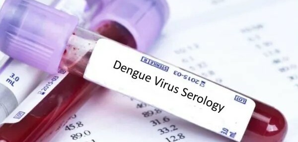 Xét nghiệm tìm kháng nguyên Dengue NS1 trong chẩn đoán sốt xuất huyết
