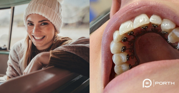 Nguồn: Porth Personalized Orthodontics 