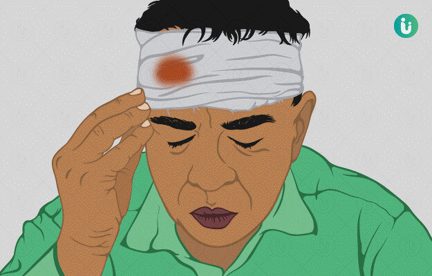 Chấn thương đầu có thể gây đau đầu, nguồn ảnh www.myupchar.com 