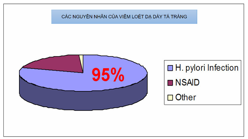 Các nguyên nhân của viêm loét dạ dày tá tràng (nguồn ảnh: https://www.slickwellness.com/) 