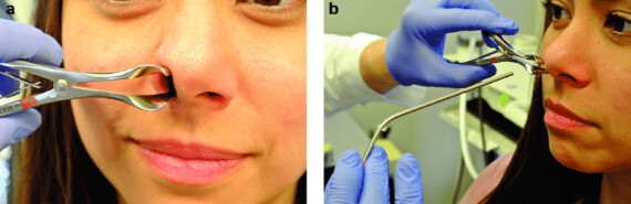 Soi mũi bằng kìm khám mũi (nguồn: https://www.researchgate.net/ ) 