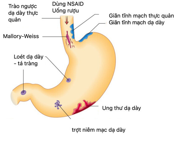 Nguồn ảnh: https://twitter.com