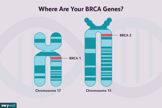 Gen BRCA1 trên NST số 17 và BRCA2 trên NST số 13 là 2 gen chính gây ung thư vú (nguồn ảnh: https://www.verywellhealth.com/)