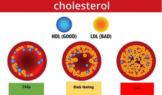 Các loại cholesterol trong máu. Nguồn: Sức khỏe đời sống