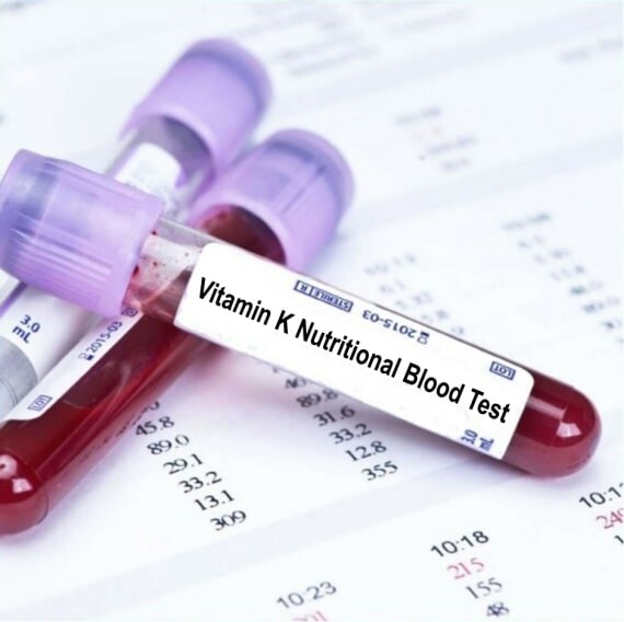 Có thể chẩn đoán thiếu hụt vitamin K bằng xét nghiệm máu đơn giản. Ảnh: bloodtestslondon.com