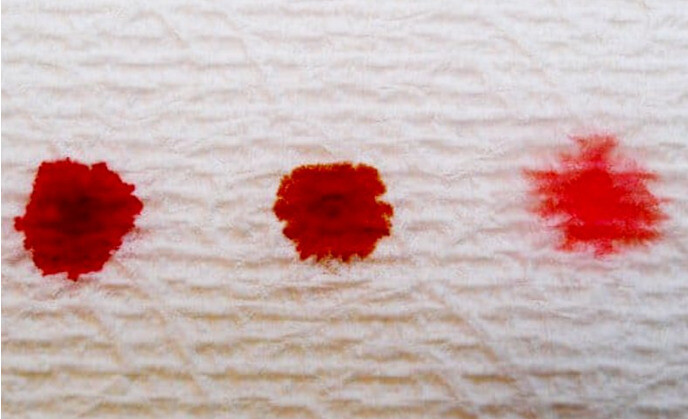 Ra máu báo có thể là một dấu hiệu của hiện tượng phôi thai làm tổ. Nguồn ảnh: freemalaysiatoday.com