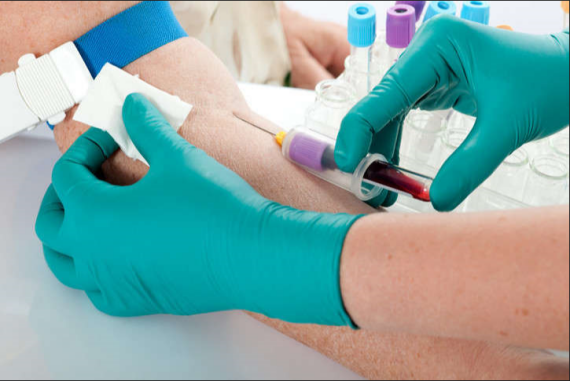 Lấy mẫu máu xét nghiệm, nguồn ảnh e7health.com