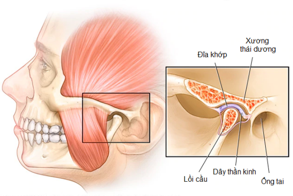 Khớp thái dương hàm là một cấu trúc phức tạp có chứa cơ, gân và xương nối giữa xương hàm dưới và khối xương sọ ở phía trên. (nguồn: bvtt-tphcm.org.vn)