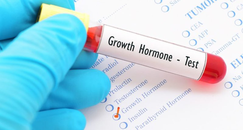 Hormone tăng trưởng liên quan đến bệnh ung thư phổi - Ảnh 1