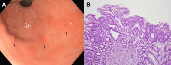 Nguồn ảnh: https://hccpjournal.biomedcentral.com