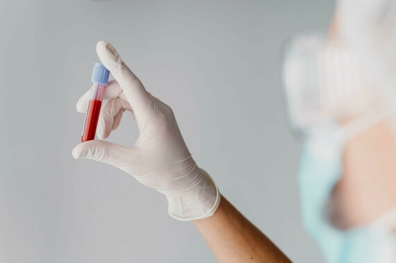 Làm xét nghiệm là phương pháp nhanh nhất giúp phát hiện HIV | Nguồn ảnh: Freepik