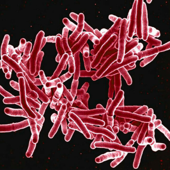 Trực khuẩn Mycobacterium tuberculosis là nguyên nhân gây bệnh lao  (Nguồn ảnh: www.statnews.com)