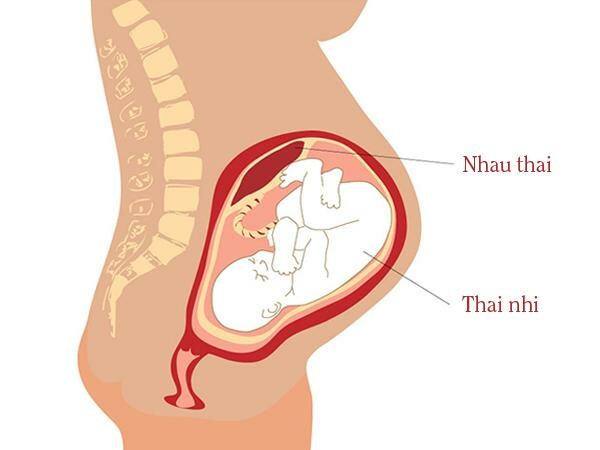 Làm thế nào để phát hiện và chẩn đoán rau bám đáy tử cung?
