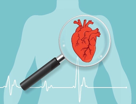Căng thẳng kéo theo các bất thường trong hoạt động của tim mạch (nguồn: hopkinsmedicine.org)