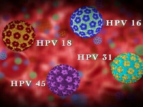 Chủng virus HPV phổ biến gây bệnh sùi mào gà. Nguồn ảnh : cn-healthcare.com