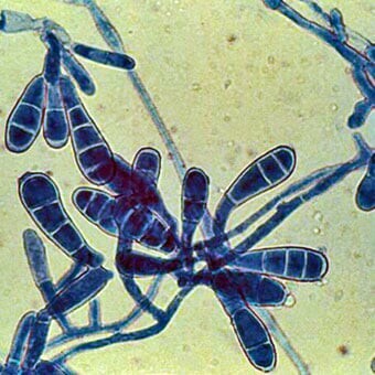 Hình ảnh nấm Dermatophytes dưới kính hiển vi (nguồn ảnh: https://www.medicinenet.com/)