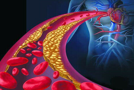 Atorvastatin giúp cải thiện mức cholesterol trong máu và là thuốc đầu tay cho những người có cholesterol cao hoặc mắc các bệnh lý tim mạch. Nguồn ảnh: Healthline
