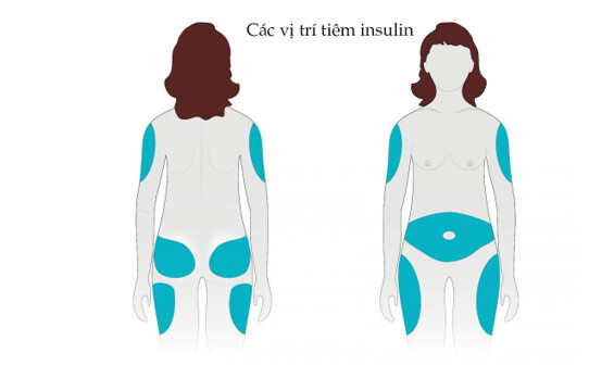 Nguồn ảnh: medicalnewstoday.com