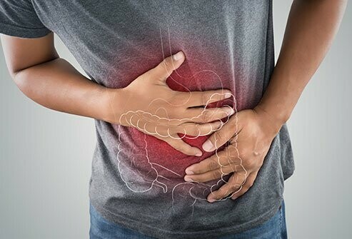 Đau bụng có thể là triệu chứng của một bệnh tại đại tràng (Nguồn ảnh medicinenet.com)
