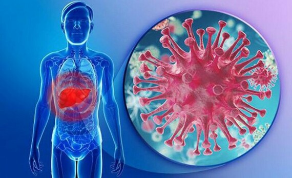 Virus viêm gan B có thể gây xơ gan, ung thư gan