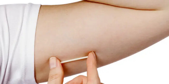 Trong số các biện pháp tránh thai nội tiết tố, que cấy tránh thai ít thành công hơn trong việc làm trì hoãn kinh nguyệt. (nguồn: insider.com)