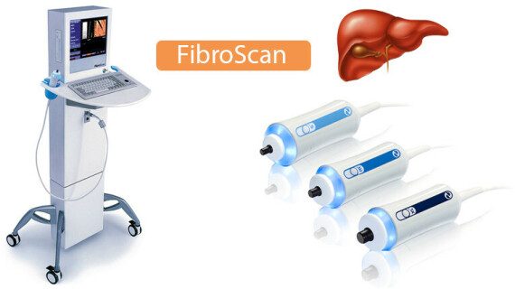 Xét nghiệm đo độ đàn hồi gan- FibroScan.Nguồn: IsofHcare