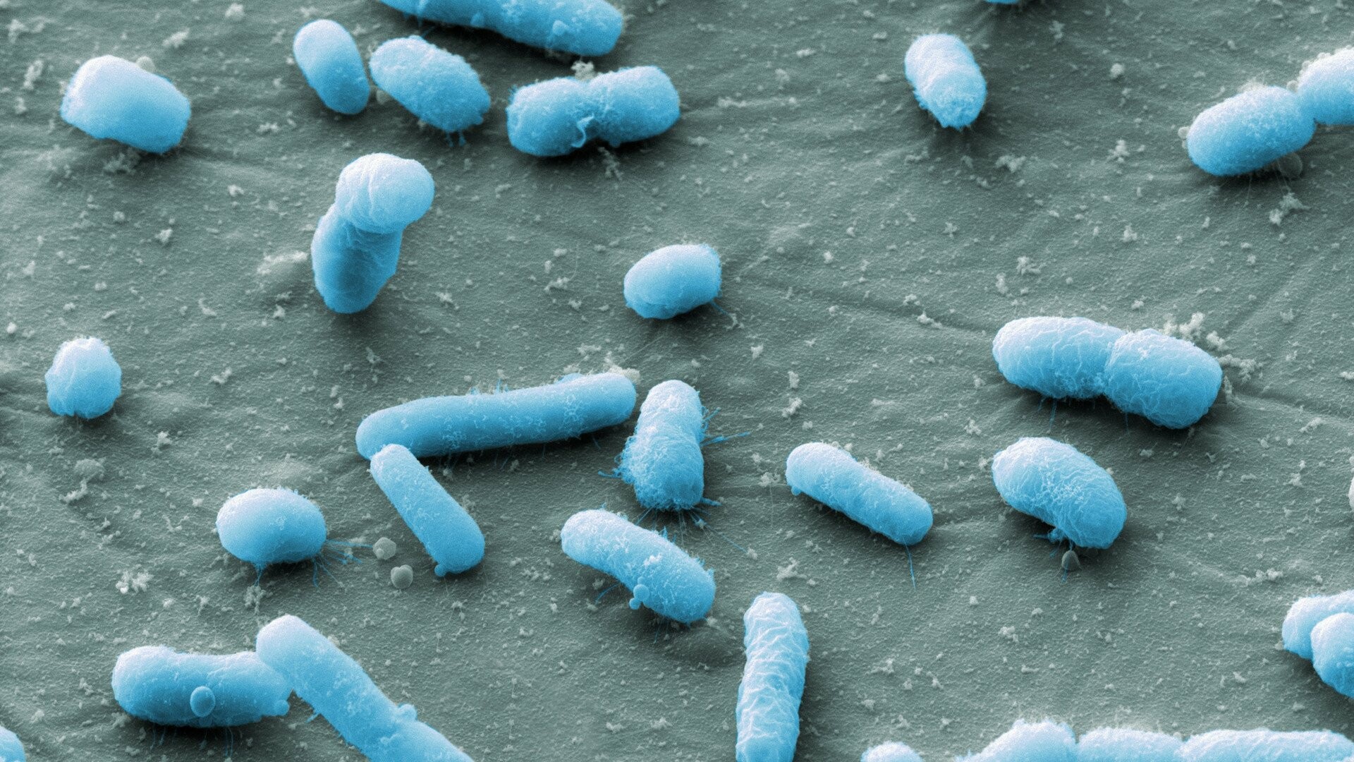 Escherichia coli (E. Coli). Nguồn ảnh: Micropia.com