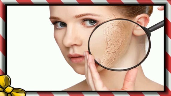 Da khô, tróc vảy, cảm giác châm chích nhẹ nóng đỏ hoặc rát da là tác dụng phụ phổ biến trong thời gian đầu sử dụng Differin. Nguồn ảnh: heyitscristine.com