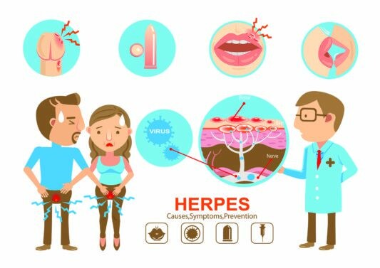 Nguyên nhân, triệu chứng và cách phòng ngừa herpes. Nguồn ảnh: wikiHow