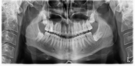 Nguồn: Radiopaedia