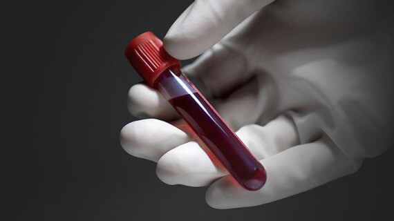 Mẫu máu thường được sử dụng trong xét nghiệm ADN. Nguồn ảnh: www.everydayhealth.com