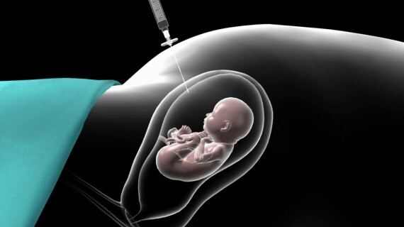 Chọc ối được chỉ định vào khoảng giữa tuần thứ 15 đến 18 của thai kỳ nếu nghi ngờ có bất thường. Nguồn ảnh: hopkinsmedicine.org