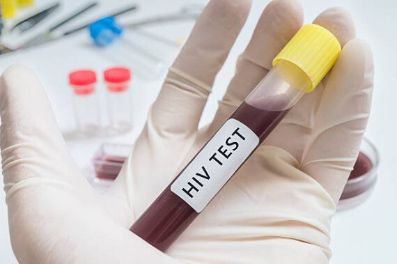 Có nhiều loại xét nghiệm giúp chẩn đoán HIV | Nguồn ảnh: Pinterest