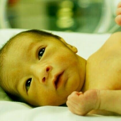 Tình trạng vàng da ở trẻ sơ sinh rất phổ biến. Nguồn ảnh: Pinterest.com
