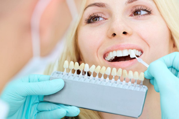 Nha sĩ có thể đưa ra các lựa chọn tẩy trắng răng tốt nhất cho bạn và giám sát kế hoạch điều trị để tránh các biến chứng. (nguồn: drgregoryhillyard.com)
