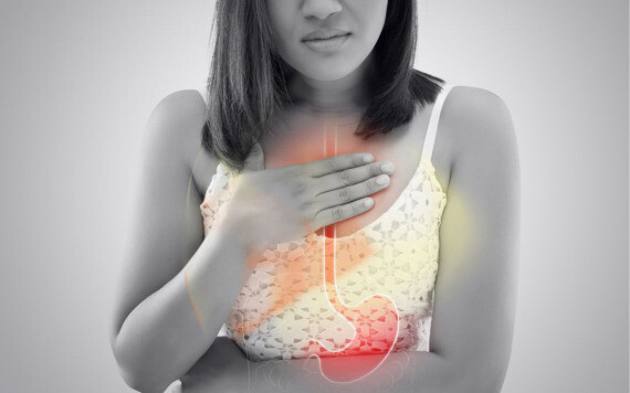 Ợ chua là cảm giác nóng rát khó chịu ở ngực, có thể di chuyển lên cổ họng; xảy ra khi dịch tiêu hóa có tính axit từ dạ dày trào ngược lên thực quản.(nguồn: lap-associates.com)