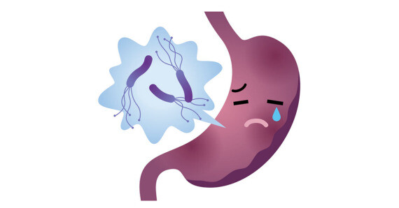 Buồn nôn là triệu chứng thường gặp trong bệnh viêm dạ dày ruột do vi rút, nguồn ảnh essentialprobiotics.com