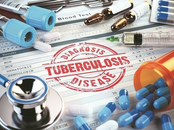 India needs to fight multi drug-resistant tuberculosis, before it gets late  | Business Standard NewsĐiều trị bệnh lao không triệt để có thể dấn đến lao đa kháng thuốc. Nguồn: Business Standard