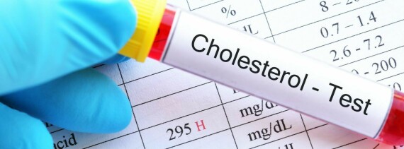 Định lượng cholesterol thường xuyên để phát hiện bệnh và điều trị kịp thời (Nguồn ảnh: Step One foods) 