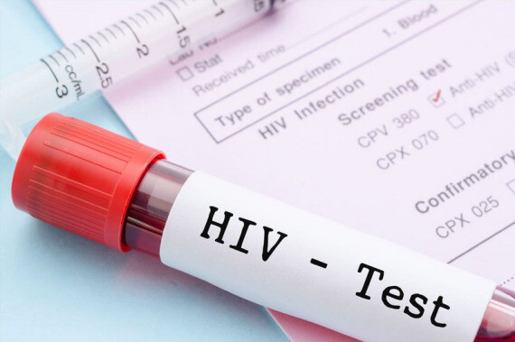 Xét nghiệm HIV | Nguồn: Pinterest