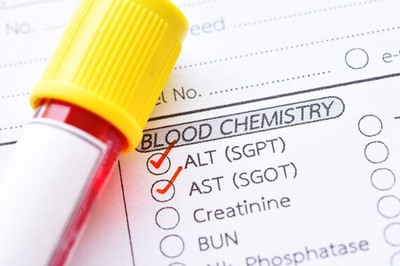 Xét nghiệm ALT và AST được dùng để đánh giá chức năng gan. (nguồn: mdanderson.org)