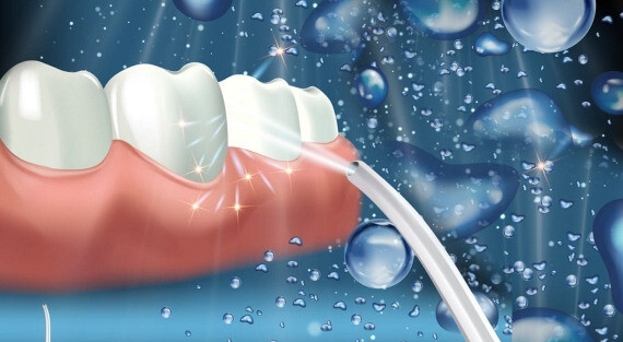 Máy tăm nước giúp loại bỏ thức ăn mắc kẹt giữa các kẽ răng và vi khuẩn tồn đọng. (nguồn: suburbanessexdental.com)