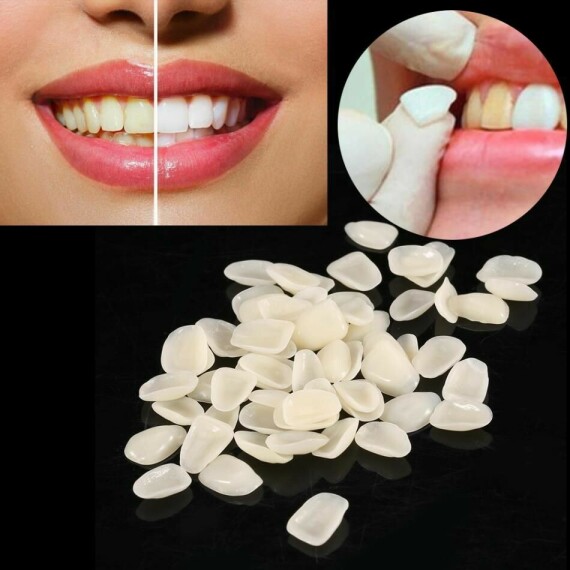 Cheap Dental Material Instruments Porcelain Teeth Temporary Crown Anteriors  Teeth Care Dentist Products Online – … | Faceta em resina, Dentes, Barba  cabelo e bigodeChụp tạm dành cho răng cửa. Nguồn ảnh: Pinterest.com