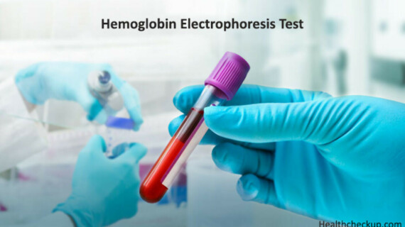 Điện di huyết sắc tố giúp đánh giá thành phần và tỷ lệ hemoglobin trong máu. Nguồn ảnh: Healthcheckup.com