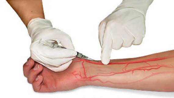 Bác sĩ tiến hành cố định động mạch quay để lấy máu. Nguồn ảnh: healthjade.com