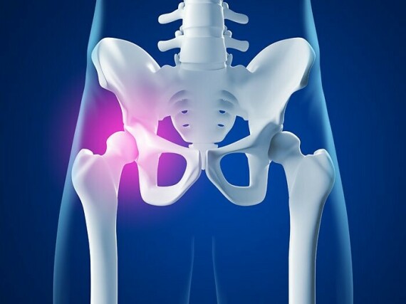 Sử dụng Prednisone kéo dài làm tăng nguy cơ loãng xương và hoại tử chỏm xương đùi.   Nguồn ảnh: ismq.org.vn