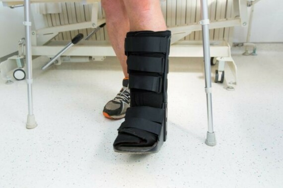 Clubfoot castPhải bó bột để giúp định hình lại bàn chân. Nguồn ảnh medicalnewstoday.com